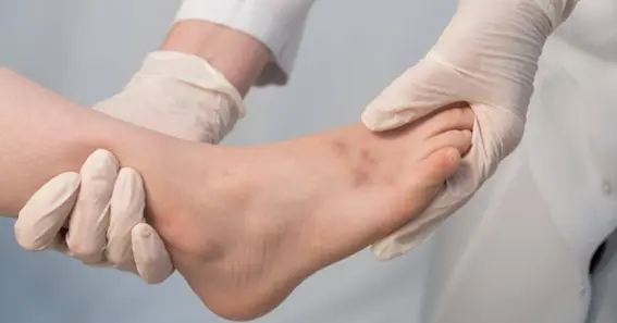 What Is A Foot Sprain